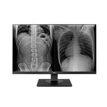 LG 8MP Clinical Review Monitor1