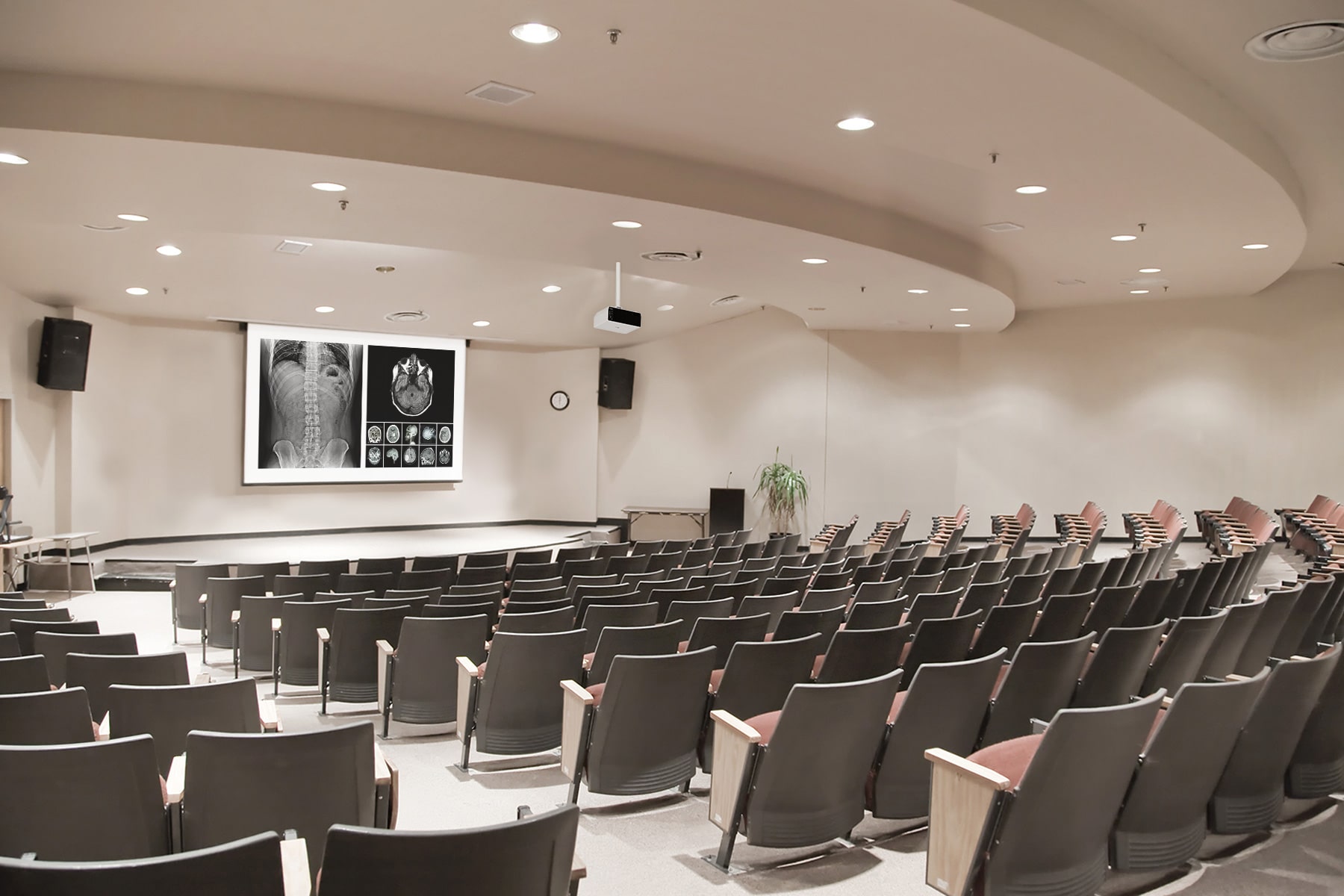 BF50 is intalled on the ceiling in medical conference room