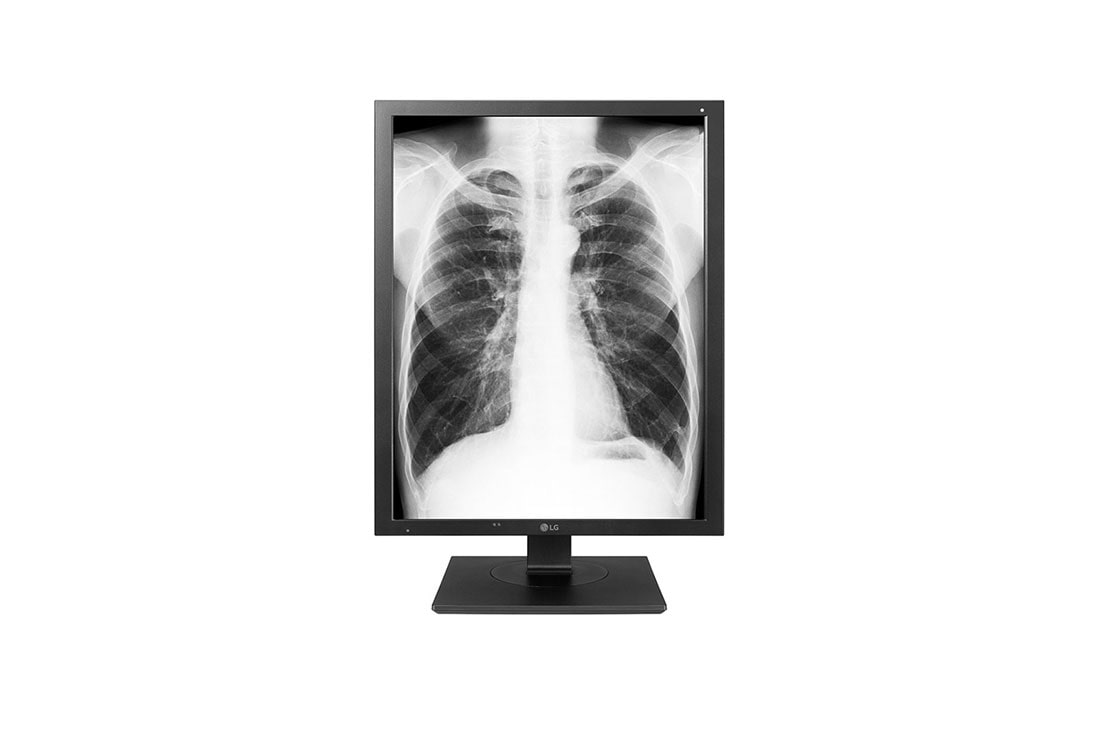 LG شاشة الفحوصات السريرية للصور الطبية، شاشة عرض 3MP IPS عالية السطوع 31.5 بوصة, 32HL512D-B