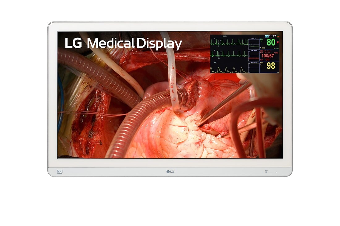 LG شاشة عمليات جراحية 27 بوصة 4K بتقنية Mini-LED إل جي, Front view, 27HQ710S-W
