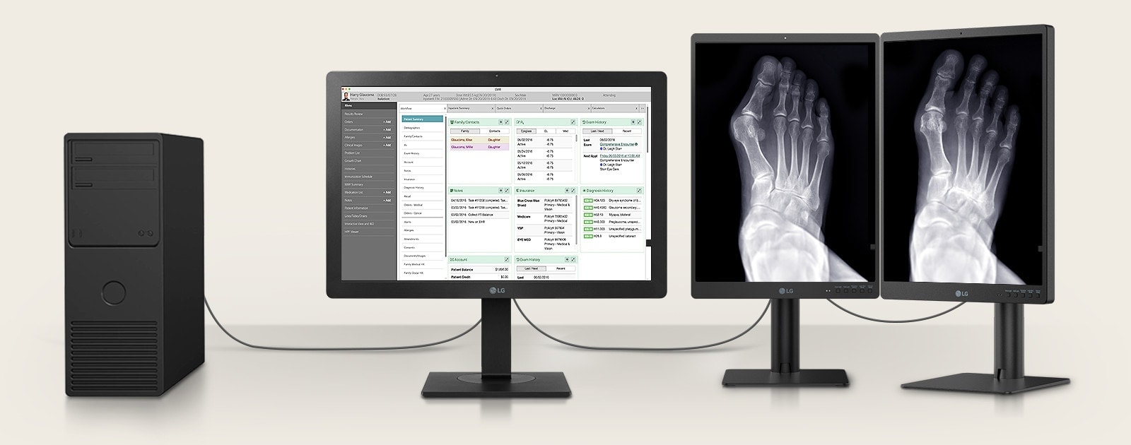 Vous pouvez connecter un 24HR513C avec deux moniteurs de diagnostic 3MP*, afin d’afficher le graphique du patient sur un 24HR513C et les images médicales sur 2 moniteurs 3MP.