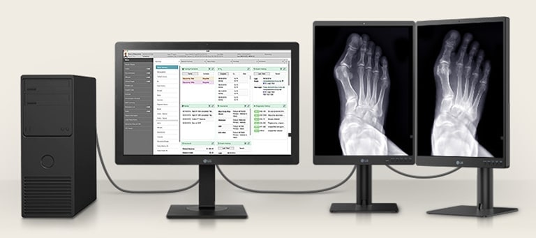 Vous pouvez connecter un 24HR513C avec deux moniteurs de diagnostic 3MP*, afin d’afficher le graphique du patient sur un 24HR513C et les images médicales sur 2 moniteurs 3MP.