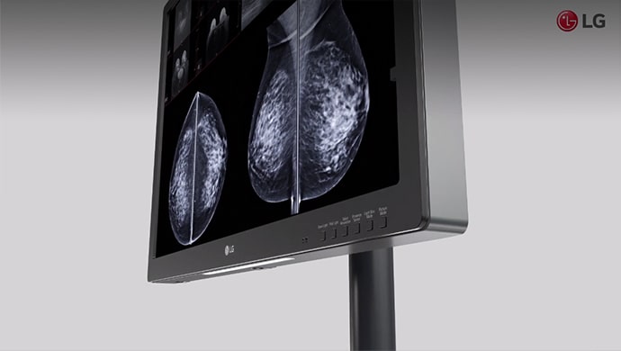 Vignette vidéo : Moniteurs de diagnostic de LG pour mammographies