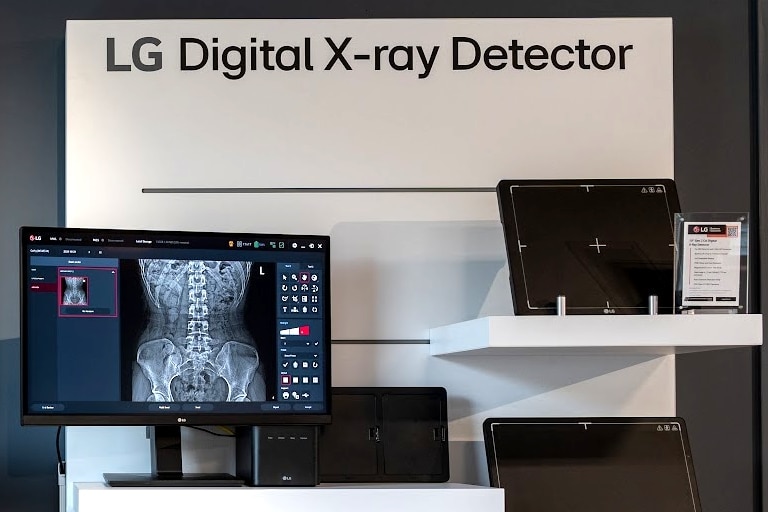 Digital X-ray Detectors