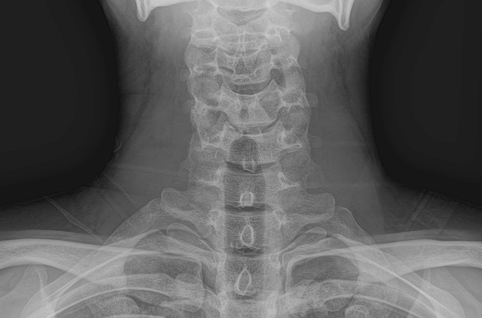 X-ray image 1.