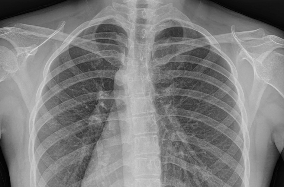 X-ray image 2