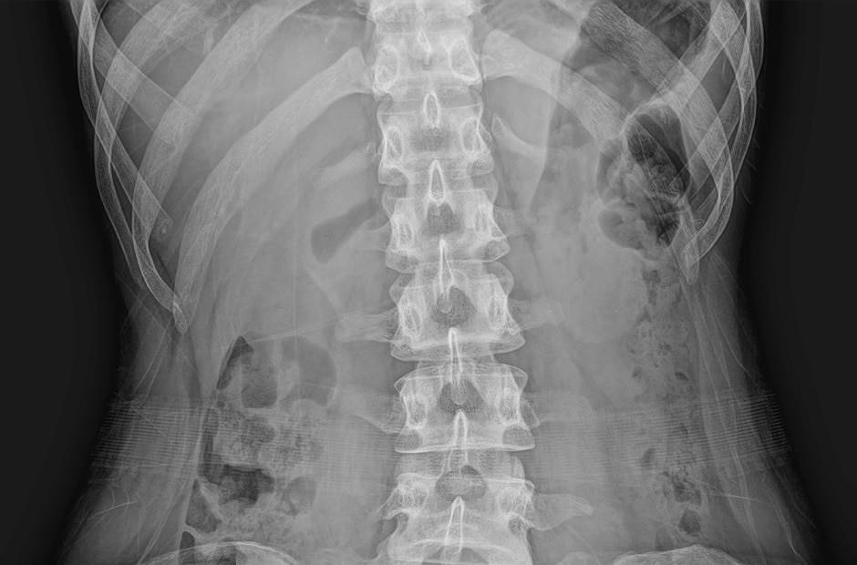 X-ray image 3
