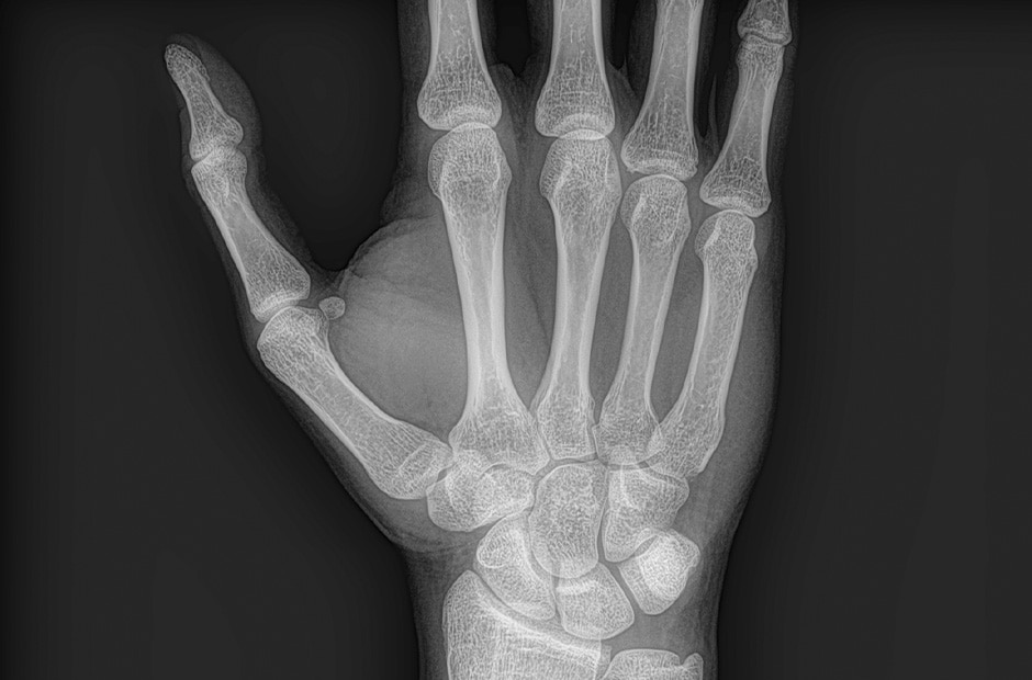 X-ray image 4