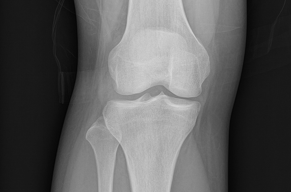 X-ray image 5