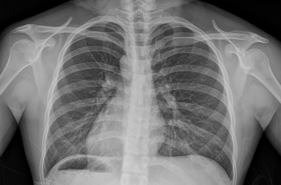 x-ray image