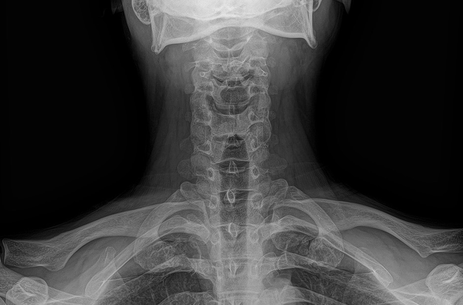 x-ray image