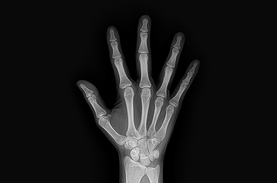 x-ray image