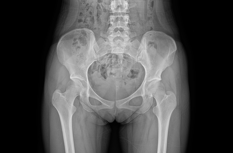 x-ray image