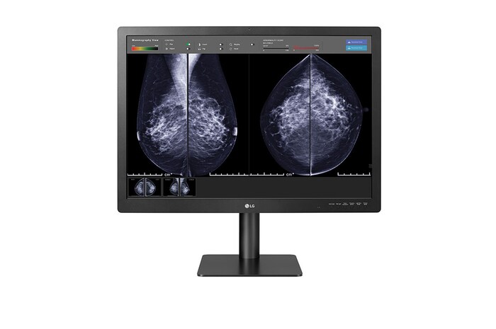 LG 31'' 12MP IPS Diagnostic Monitor for Mammography, 31HN713D-B