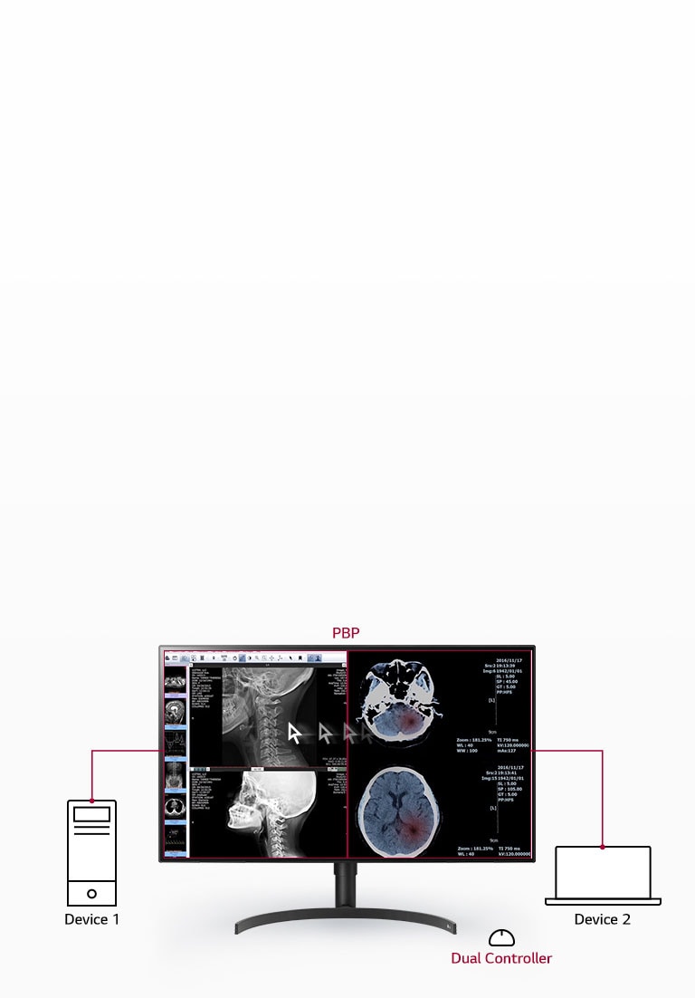 Multiple Inputs on One Screen1