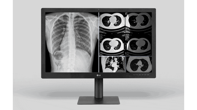 Fully Focus on the Region of Interest