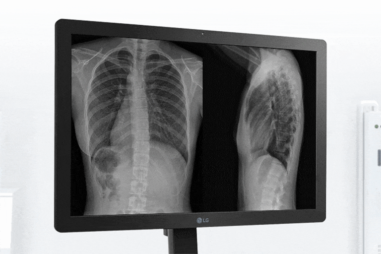 With high brightness of 600cd/m², this clinical review monitor is also suitable for diagnostic purposes.