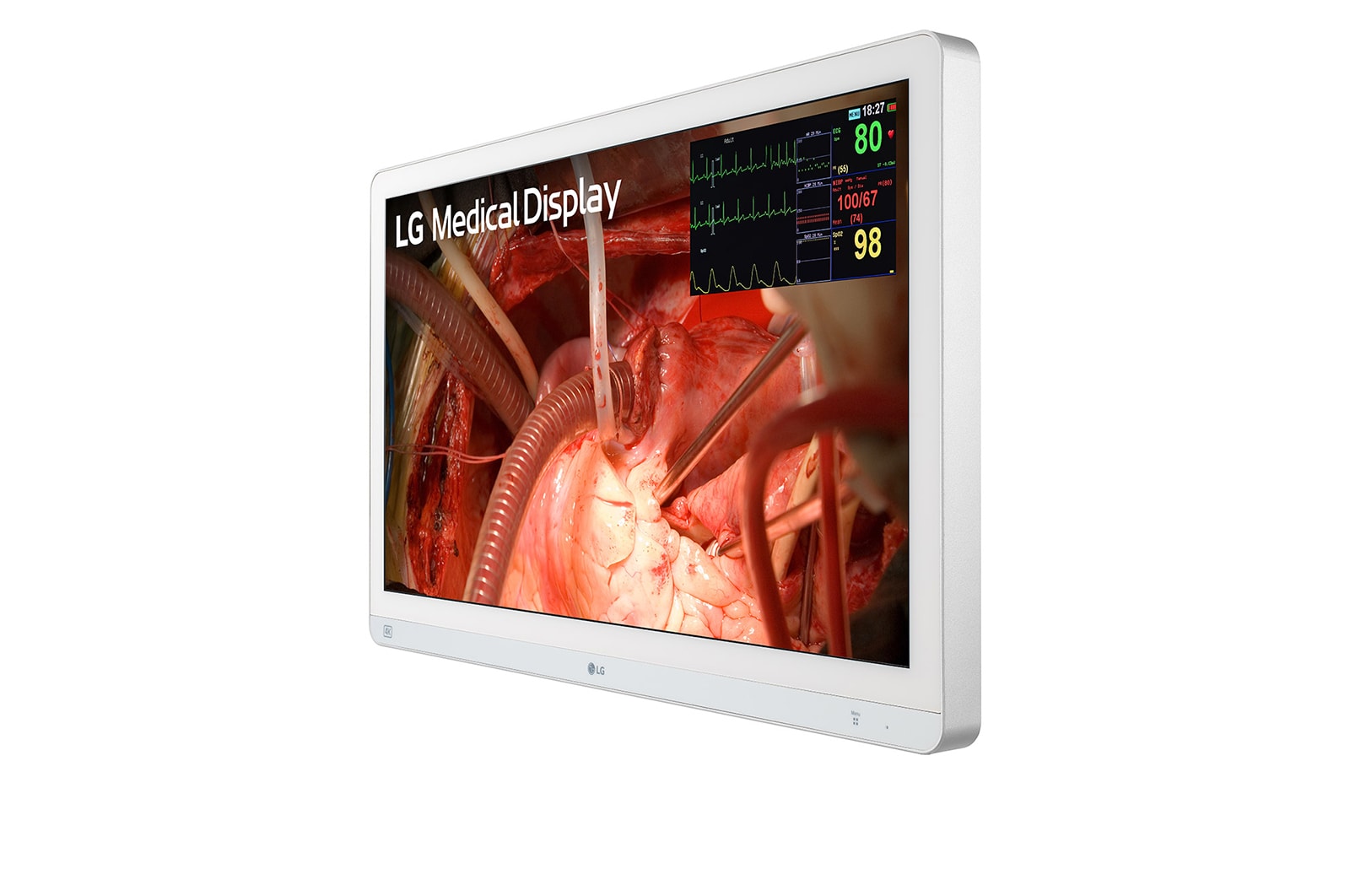 LG 27-inch 4K Surgical Monitor with Mini-LED, 27HQ710S-W