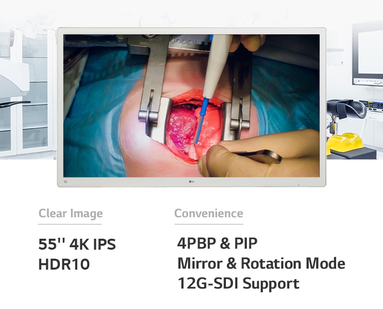 LG’s 55-inch 4K IPS Surgical Monitor 55MH5K will take your image quality and convenience to the next level.