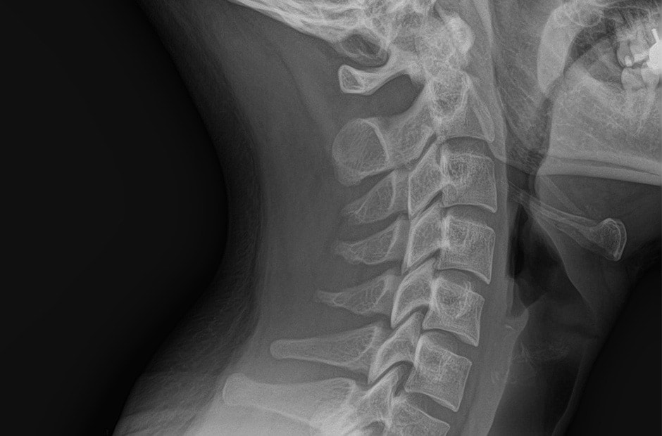 x-ray image 1.