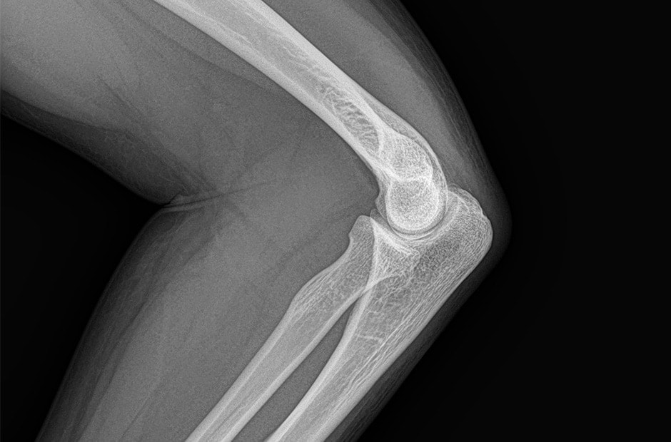 x-ray image 2.