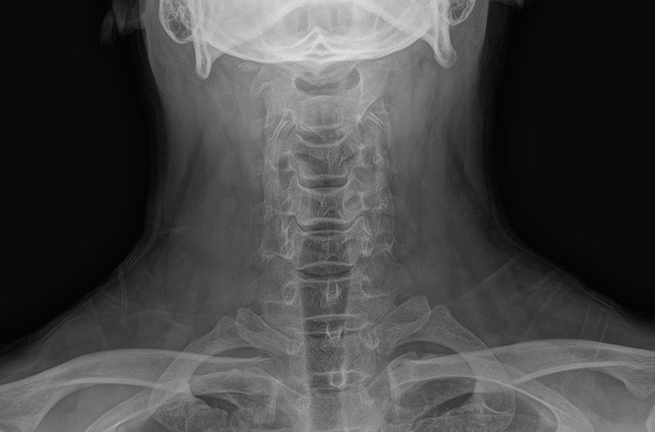 x-ray image 4.