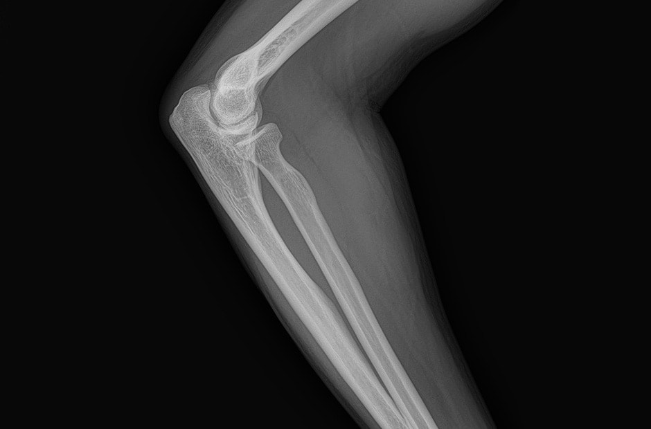 x-ray image 5.