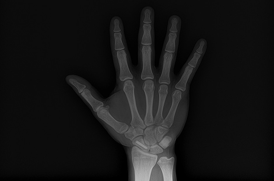 x-ray image 5.