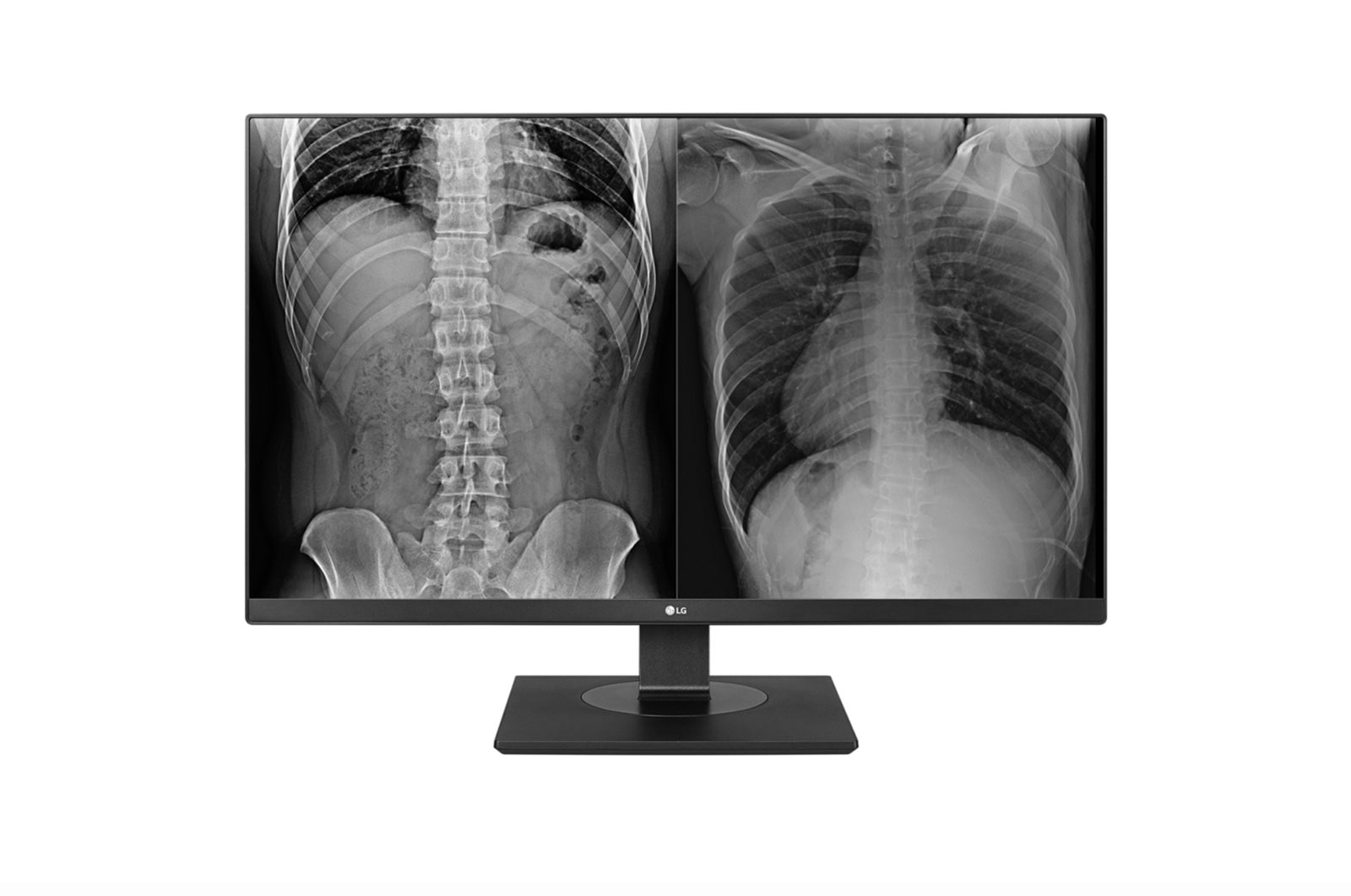 LG 27” Monitor Médico LG 8MP (4K) Preto, 27HJ713C-B