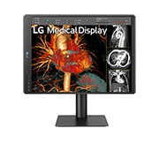 LG 21.3'' 3MP IPS Diagnostic Monitor, 21HQ513D-B