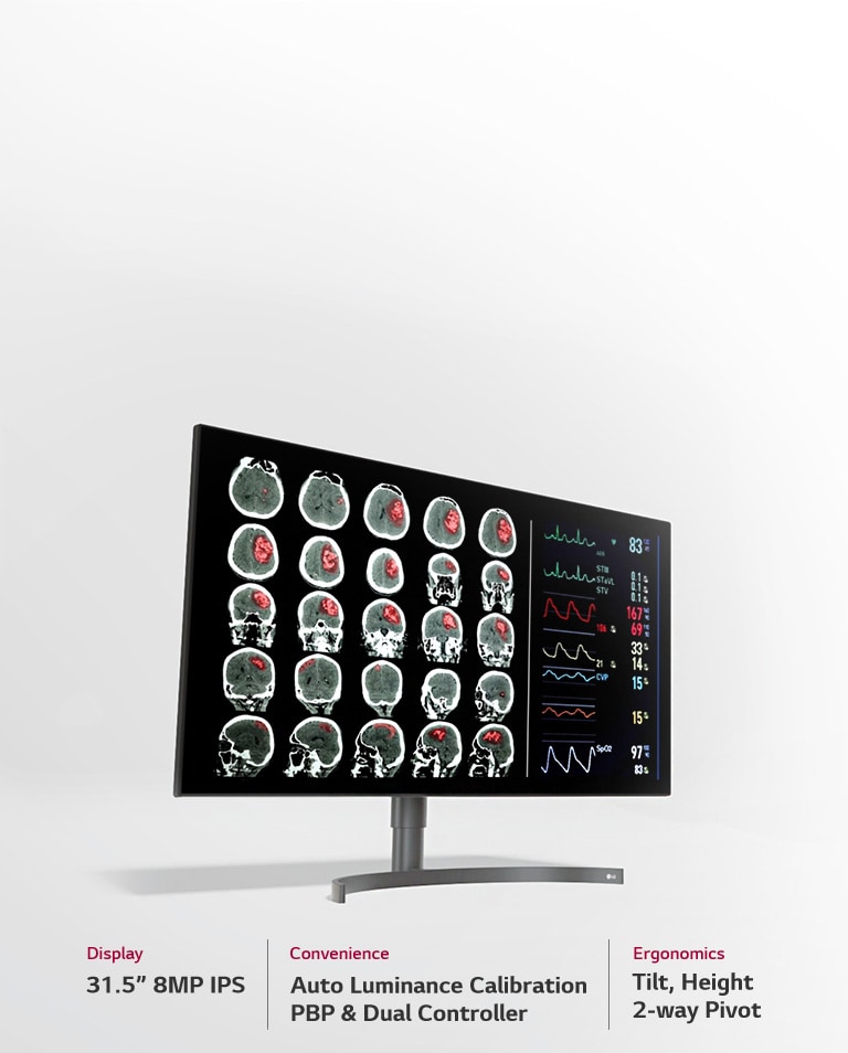 31.5" 8MP Diagnostic Monitor3