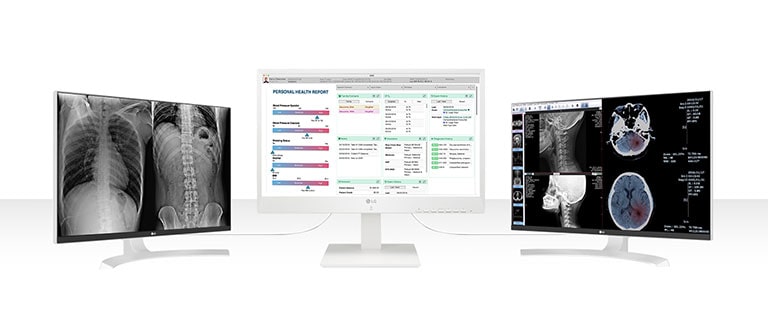 24CN650W permet de connecter jusqu’à deux écrans de résolution UHD 4K