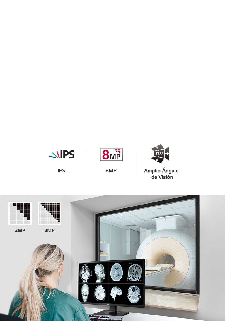 Calidad Superior de Imagen