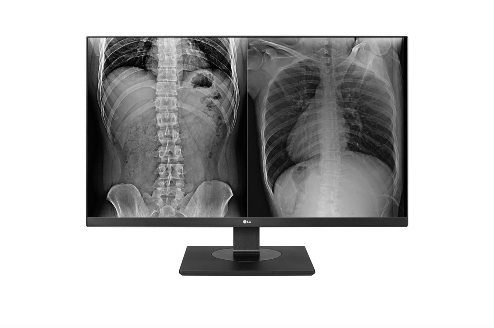 LG Monitor de Revisión Clínica de 8MP 27HJ713C, 27HJ713C-B