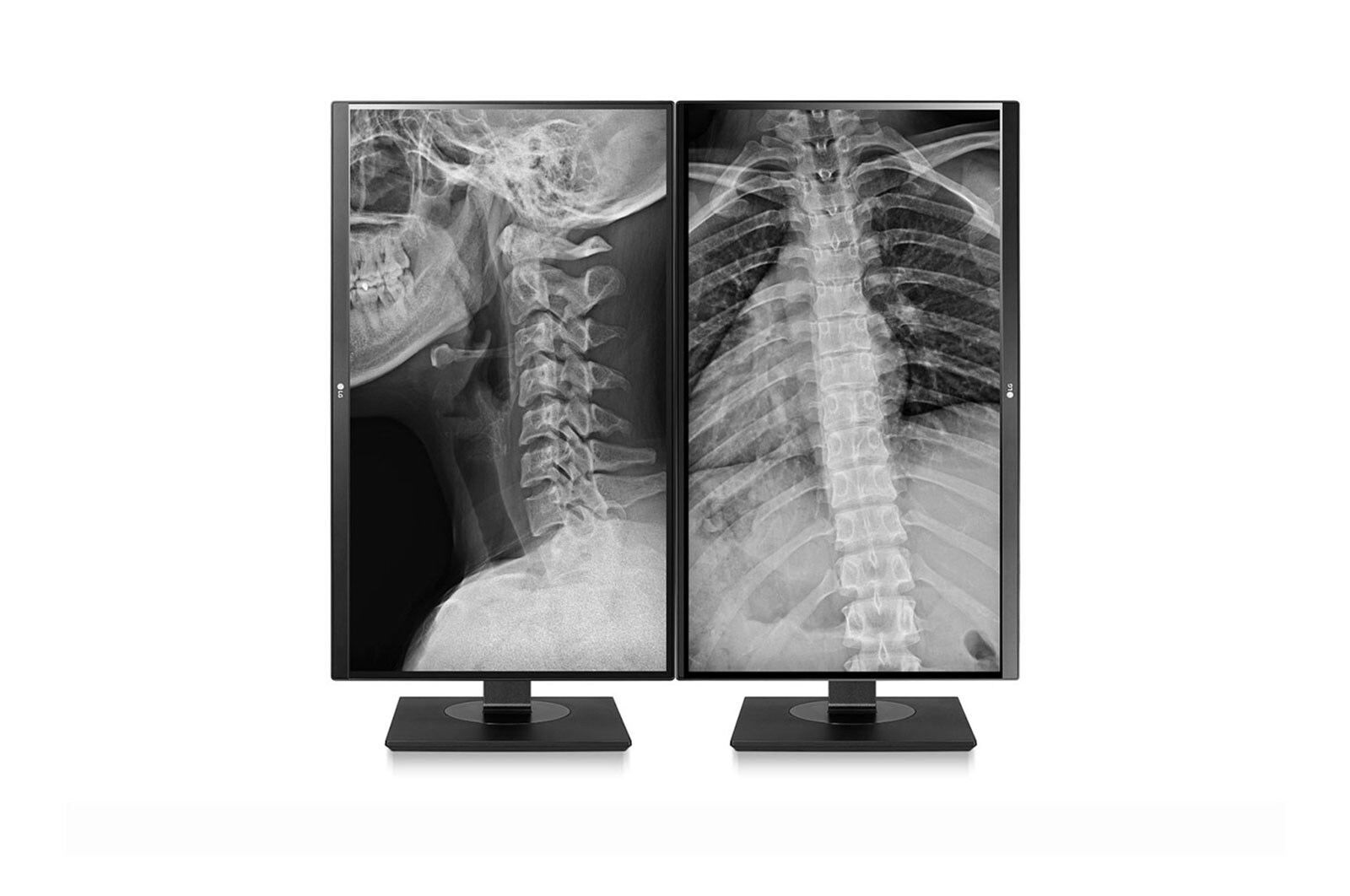 LG Monitor de Revisión Clínica de 8MP 27HJ713C, 27HJ713C-B