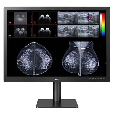 front view with mammography imaging results on the screen