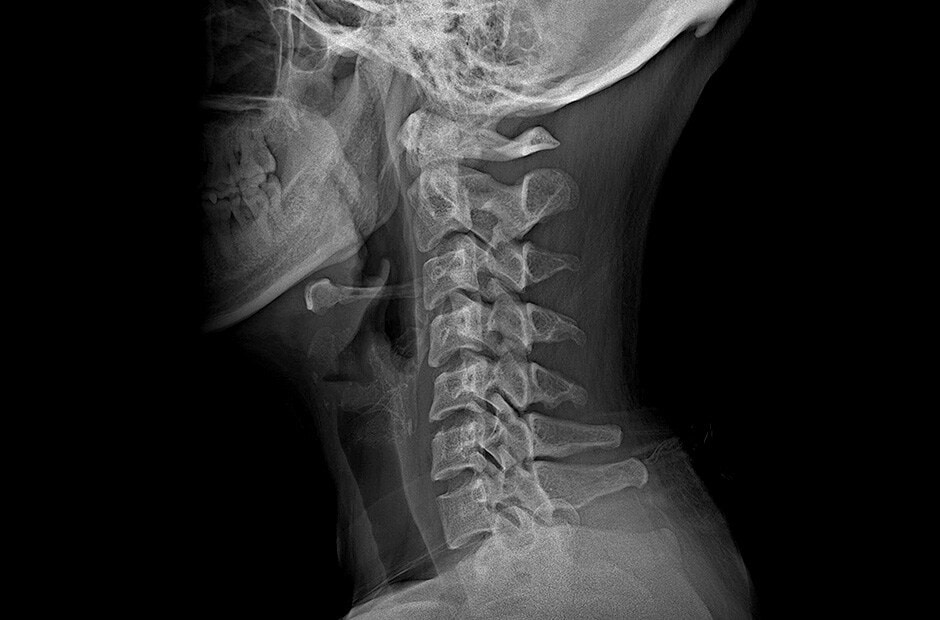 Hochauflösende und klare diagnostische Bildgebung durch den Einsatz von LG DXD.