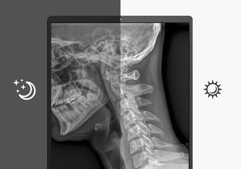 El Sensor de iluminación ofrece un ajuste automático del brillo de la pantalla en función de las condiciones de iluminación ambiental.