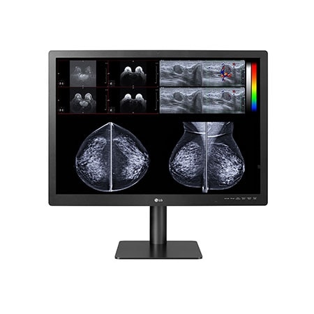 LG 31'' 12MP IPS Diagnostic Monitor for Mammography, 31HN713D
