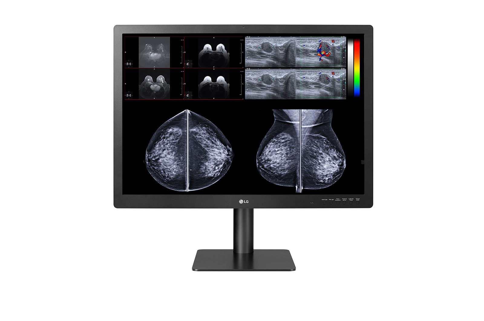 LG Monitor de Diagnóstico LG IPS 12MP, Modo Multi-Resolución, Modo Patológico, Auto Calibración, 31HN713D-BA