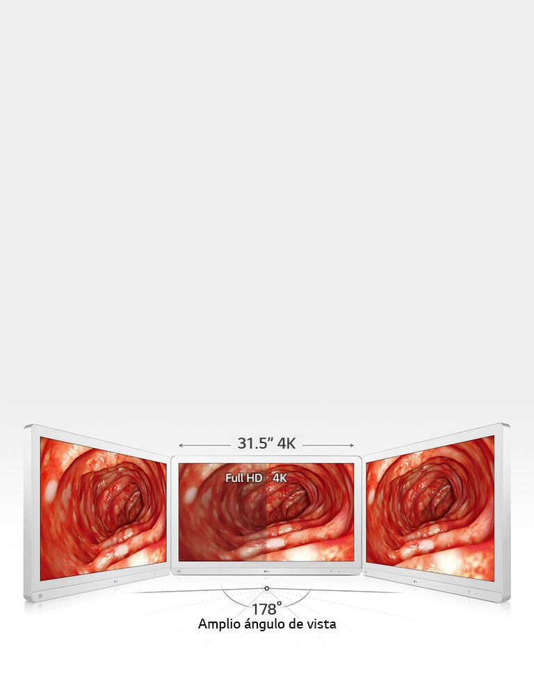 Enhanced Accuracy with Wide View