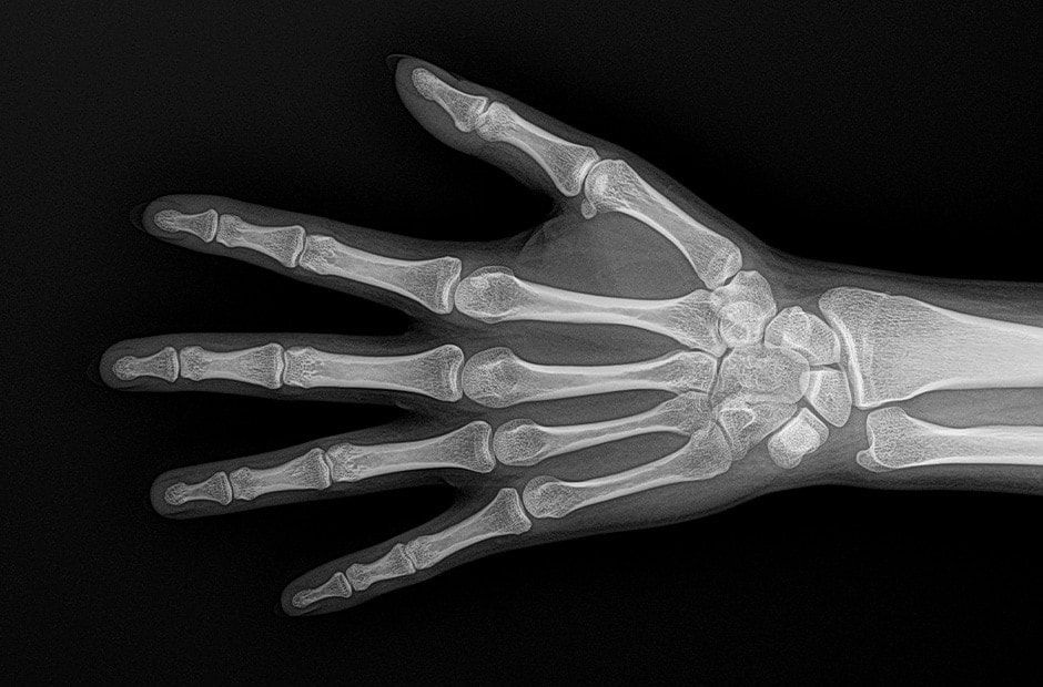 Imagen de rayos X 3.