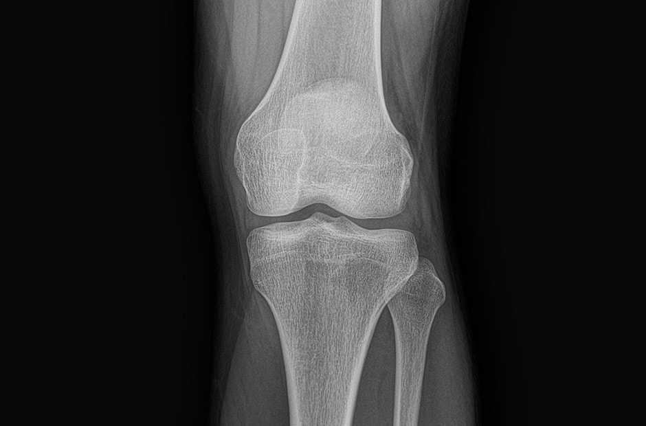 Imagen de rayos X 4.