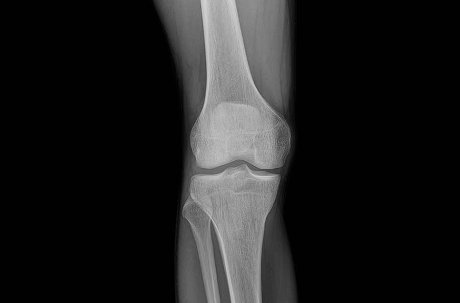 x-ray image 5.