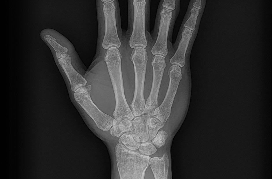 Imagen 4 rayos X