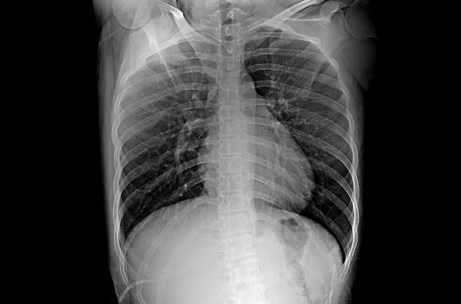 haute résolution et résultats clairs du diagnostic par imagerie en utilisant le LG DXD