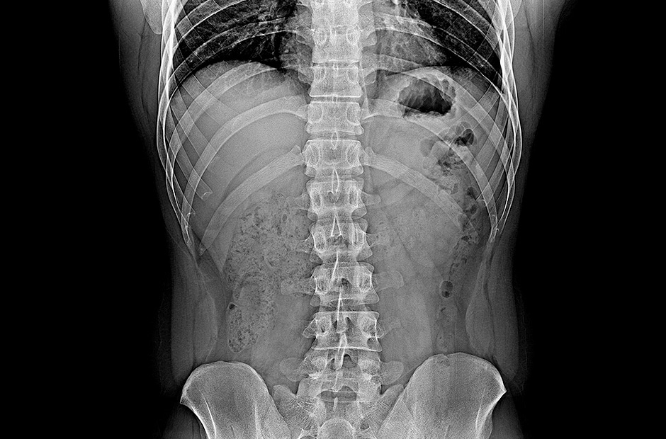 haute résolution et résultats clairs du diagnostic par imagerie en utilisant le LG DXD