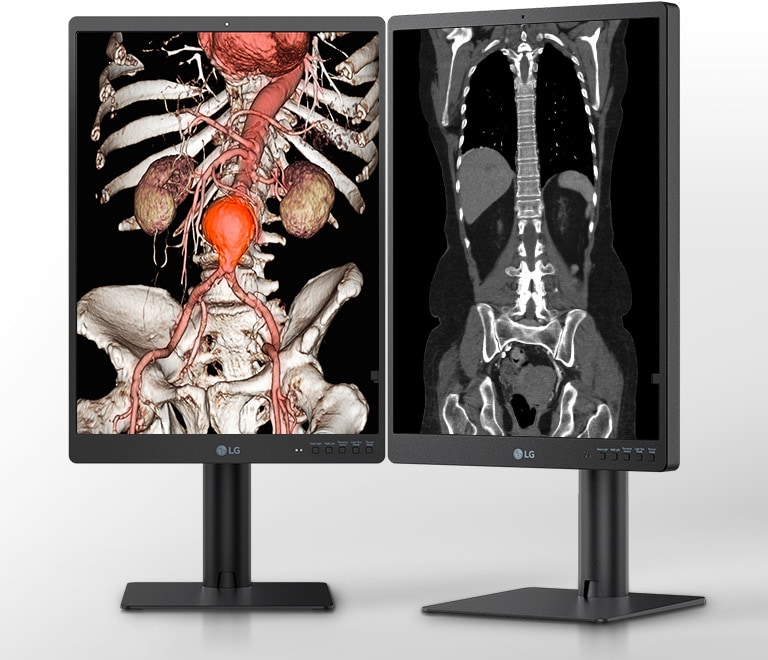 Images Précises pour un Diagnostic Précis3
