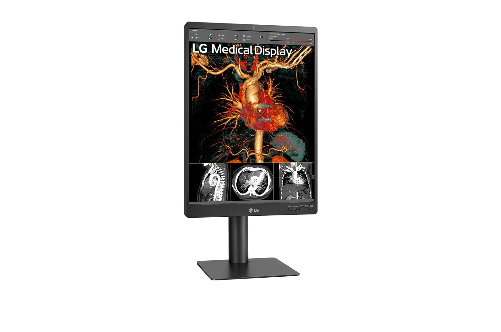 +45 degree side view with infill image