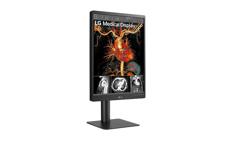 +45 degree side view